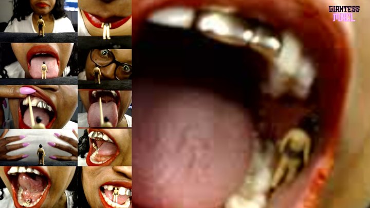Maeling - Tiny Dentist Fixed Giant Teeth - A Battle of Trust, Vore, Shrinking Fetish And Mouth Fetish